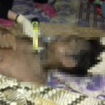 kondisi korban pembunuhan