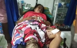 Menjebak Babi, Pasutri Ini Malah Diserang Beruang pasutri diserang beruang