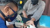 Disdamkarmat Lepaskan Cincin dari Jari Warga