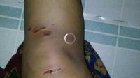Serangan Buaya Tak Pengaruhi Aktivitas Warga Lampuyang Cari Kerang