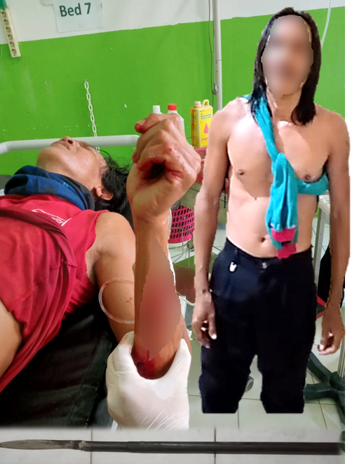 Adik Cek-cok, Kakak Menombak hingga Usus Korban Terburai