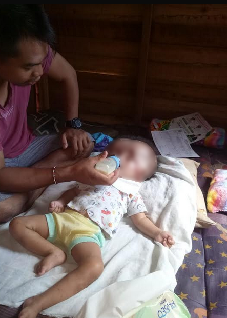 Bayi Hydrosepalus Butuh Bantuan
