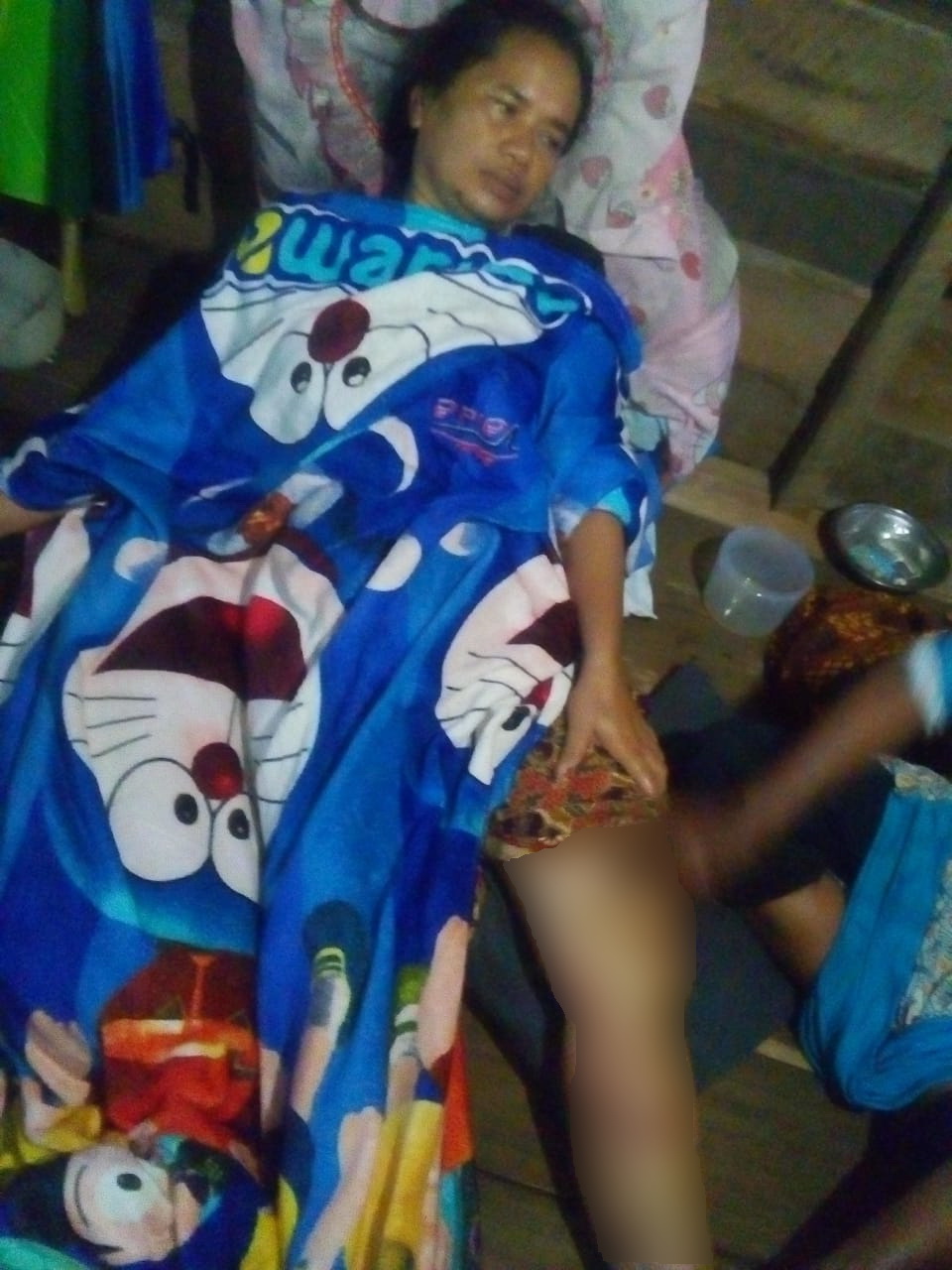 Diterkam Buaya Menyata saat Ambil Wudhu, IRT Berhasil Lolos