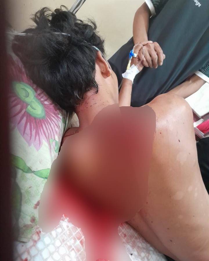 Usai Duel Minum Miras, Bapak Bacok Anak Tiri