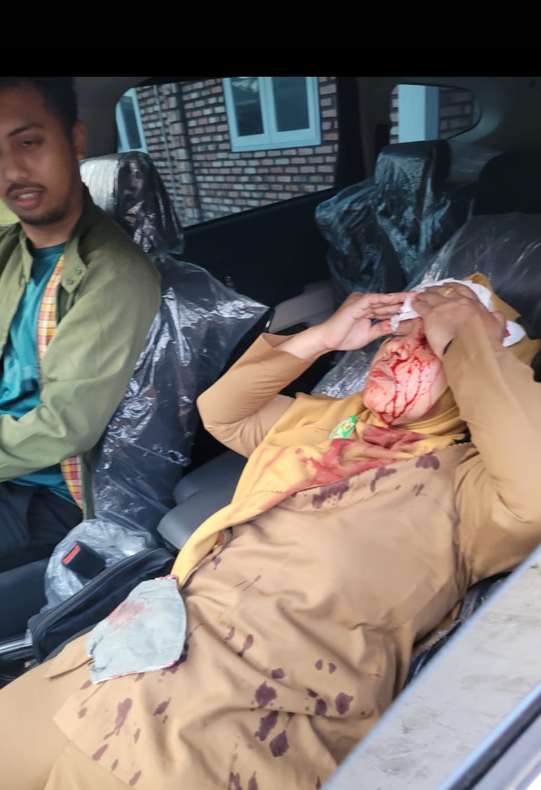 Gegara Benang Layangan, Dahi PNS Kotim Luka Serius