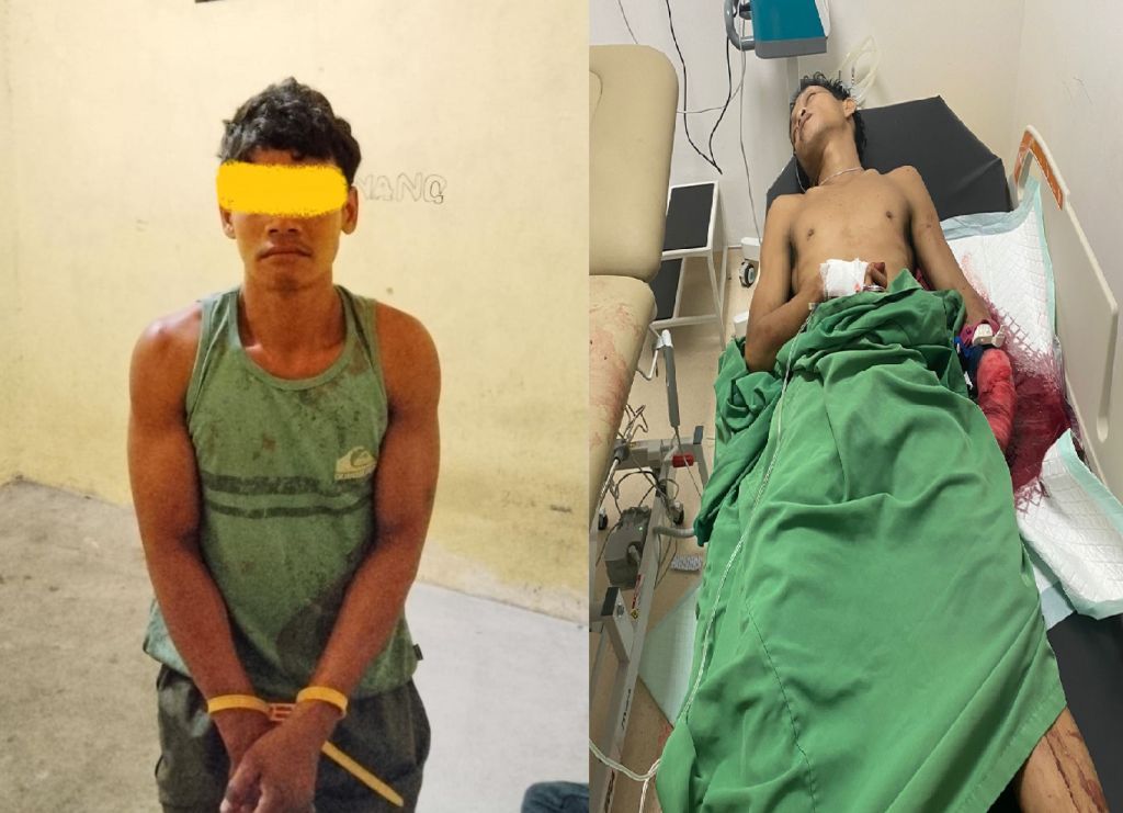 Lerai Cekcok Keluarga, Warga Tanjung Hara Jadi Korban Penganiayaan