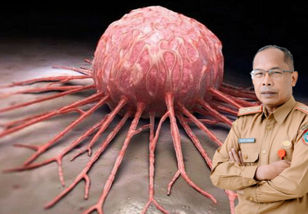 4.000 Warga Kalteng Derita Kanker