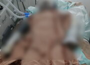 9 Hari Dirawat, Korban Pembakaran Mantan Suami Meninggal Dunia